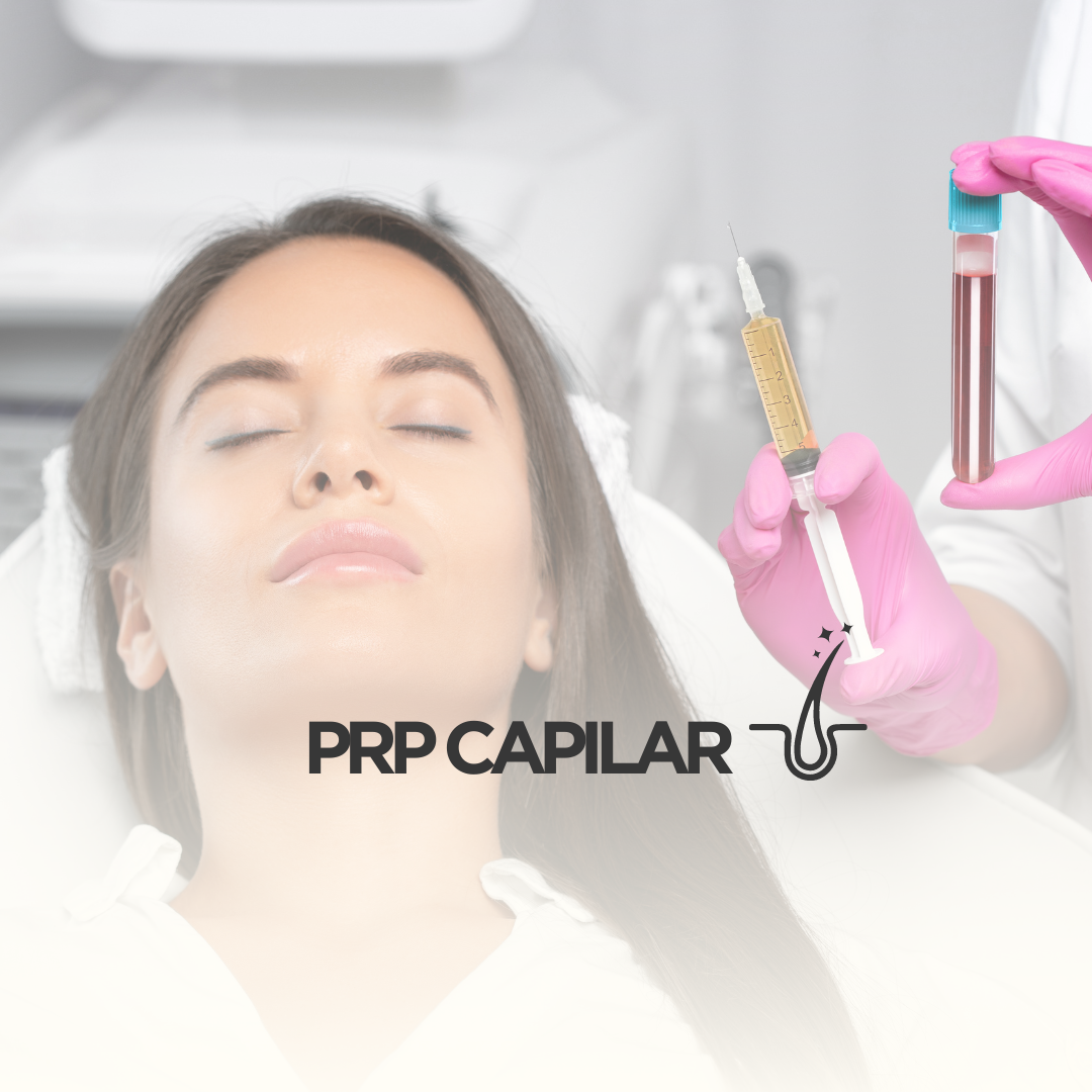 Paciente recibiendo tratamiento de PRP capilar, utilizando plasma rico en plaquetas para estimular el crecimiento del cabello