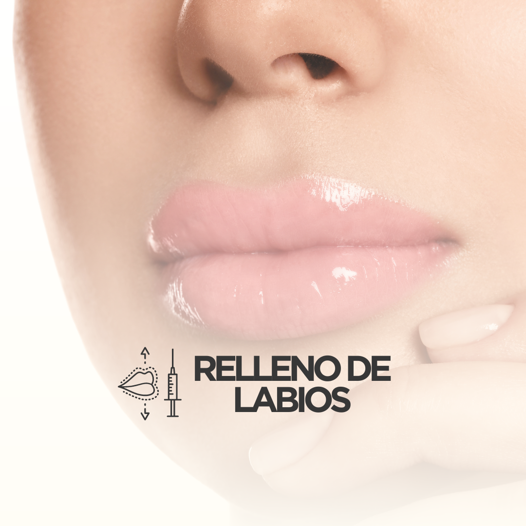 Labios con volumen y brillo, representando resultados de relleno con ácido hialurónico para embellecimiento labial