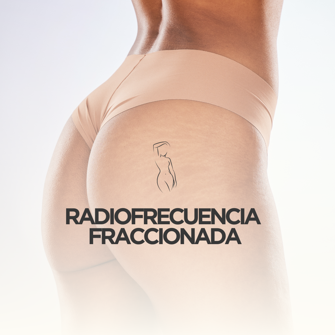 Tratamientos de radiofrecuencia fraccionada para reafirmar y mejorar la textura de la piel